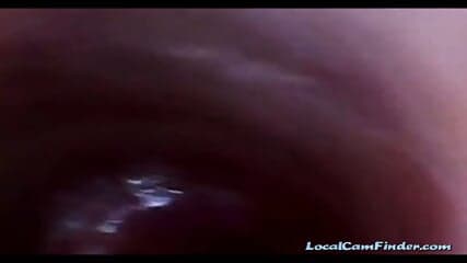 Endoscope POV: Test Tube Cock Urethral Insertion