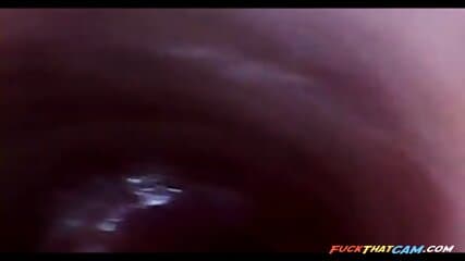 test tube cock endoscope POV urethral insertion ball rod