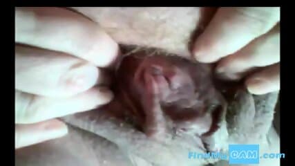 another gyno cam with my good aunty